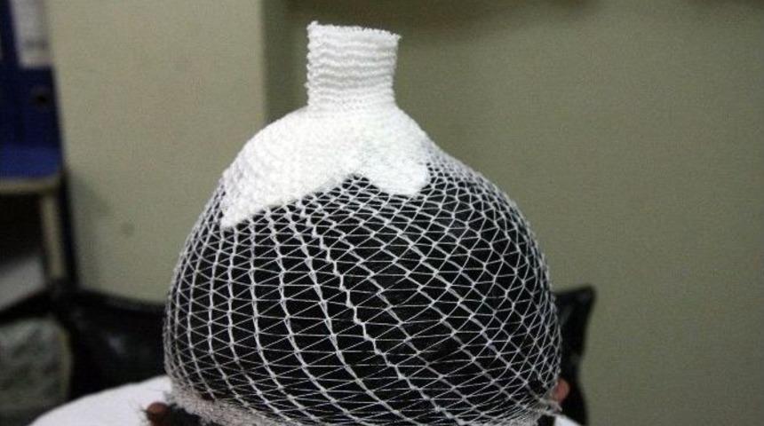 &Ccedil;orum&rsquo;da Maganda Kurşunu Az Kalsın Can Alıyordu