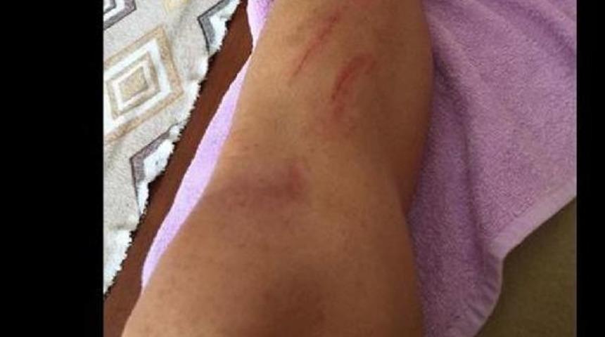 Antalyasporlu Futbolcudan Fotoğraflı Tepki