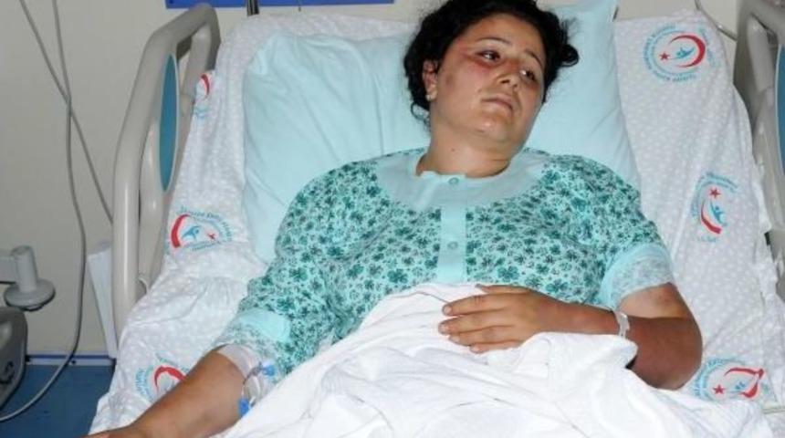 Eşini Keser Ve &Ccedil;eki&ccedil;le D&ouml;verek Hastanelik Etti