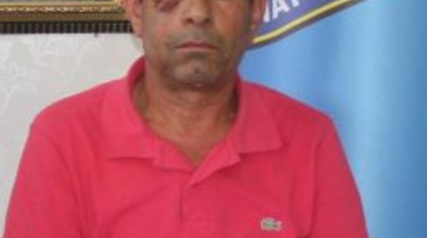 Tinerci Taksi Şof&ouml;r&uuml;n&uuml; Darp Etti