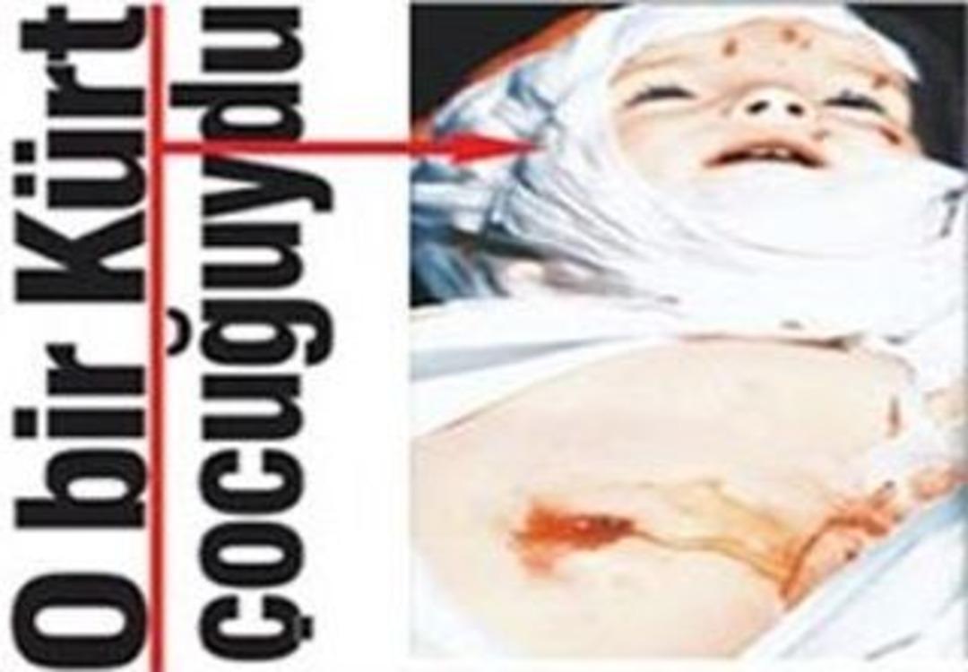 (&ouml;zel Haber) Pkk&rsquo;nın Katlettiği O Bebeğin Ailesi Konuştu: