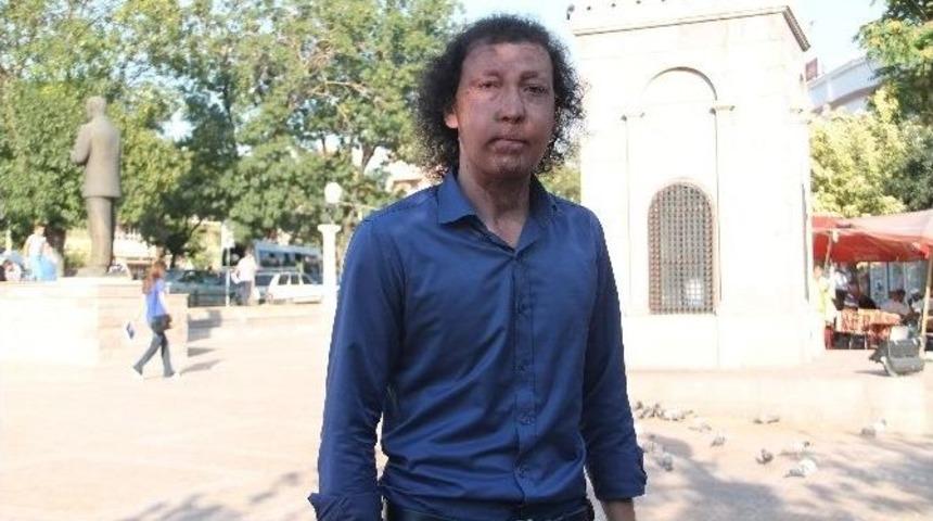 (&ouml;zel Haber) Y&uuml;z Nakilli Cengiz G&uuml;l, Ak Parti&rsquo;den Aday Adayı Oldu