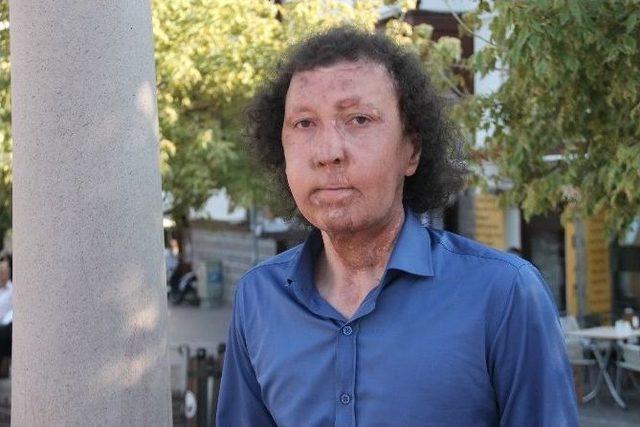 (&ouml;zel Haber) Y&uuml;z Nakilli Cengiz G&uuml;l, Ak Parti&rsquo;den Aday Adayı Oldu 1