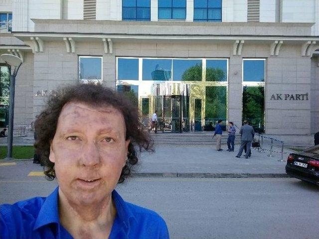 (&ouml;zel Haber) Y&uuml;z Nakilli Cengiz G&uuml;l, Ak Parti&rsquo;den Aday Adayı Oldu 2