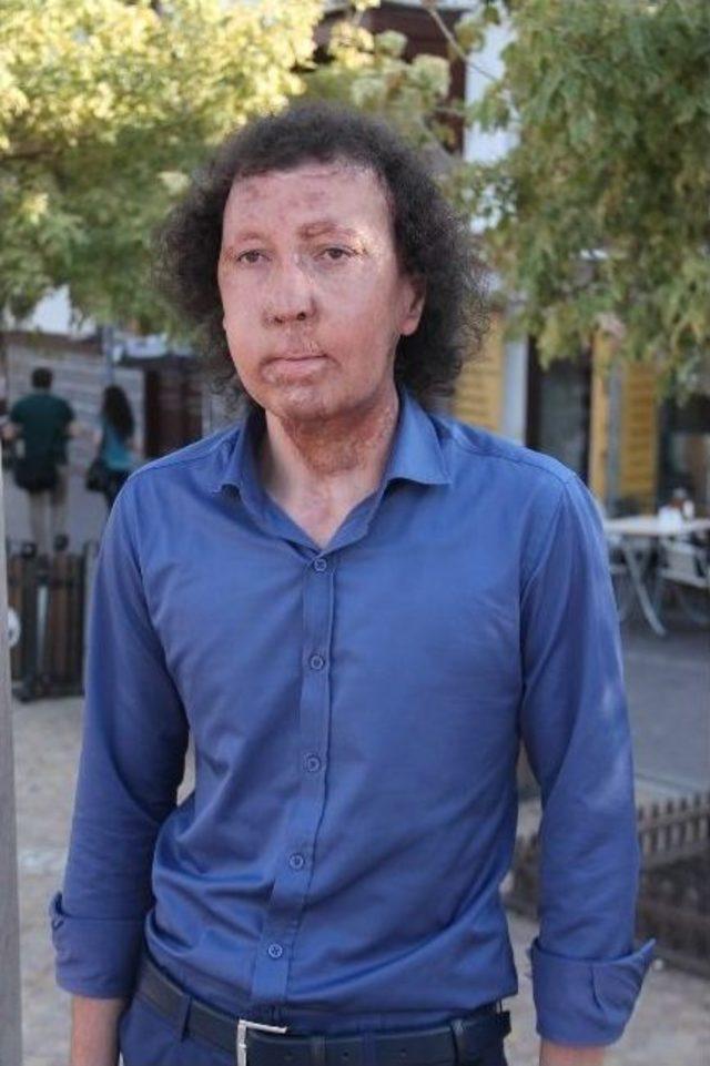 (&ouml;zel Haber) Y&uuml;z Nakilli Cengiz G&uuml;l, Ak Parti&rsquo;den Aday Adayı Oldu 3