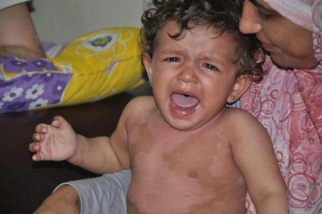 Işid in Bombasıyla Yaralanan Suriyeli Ailenin Tedavisine Başlandı 2