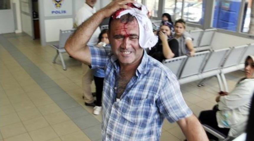 Kocaeli Ve Sakarya'da Acemi Kasaplar Yine Kendilerini Kesti