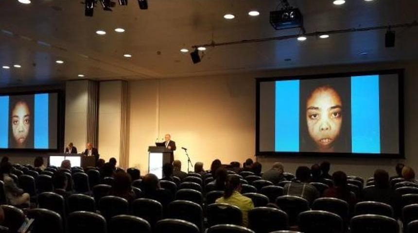 T&uuml;rk Bilim Adamı, Rusya'daki Kongrede Kendi Adını Verdiği Hastalığı Tanıttı