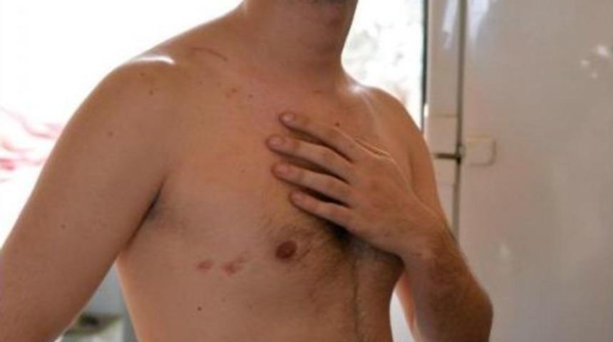 Kazadan Kurtuldu, Zabıta Kavgası Hastanelik Etti