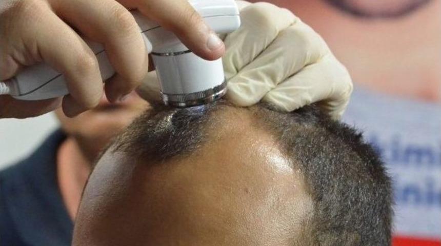 Sa&ccedil;larınızdaki D&ouml;k&uuml;lmeye Son Verin