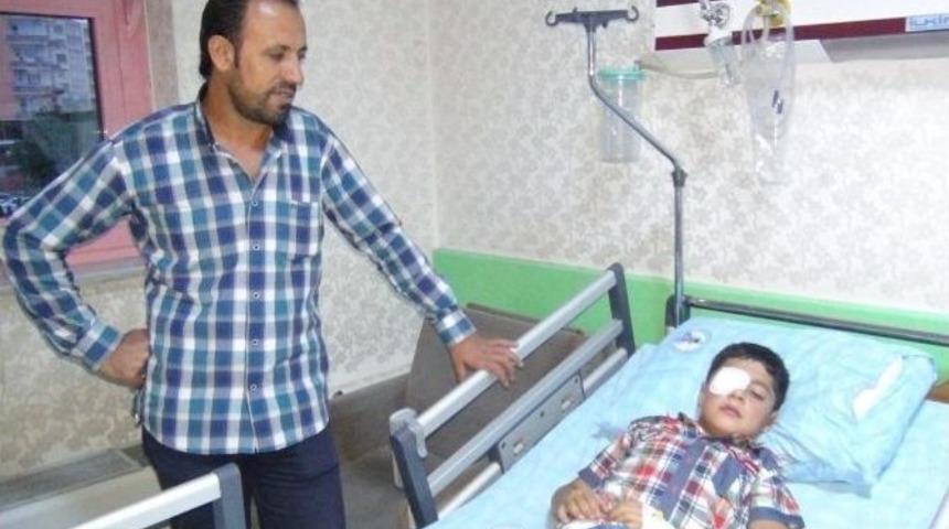 Pet Şişesine Hazırladığı Karışımın Patlaması Sonucu G&ouml;z&uuml;nden Yaralandı