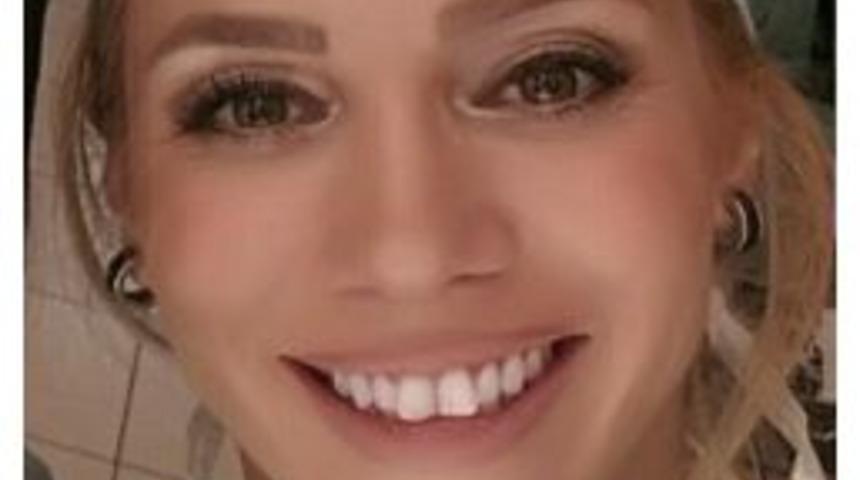 Memedeki Şekil Bozukluğuna Dikkat