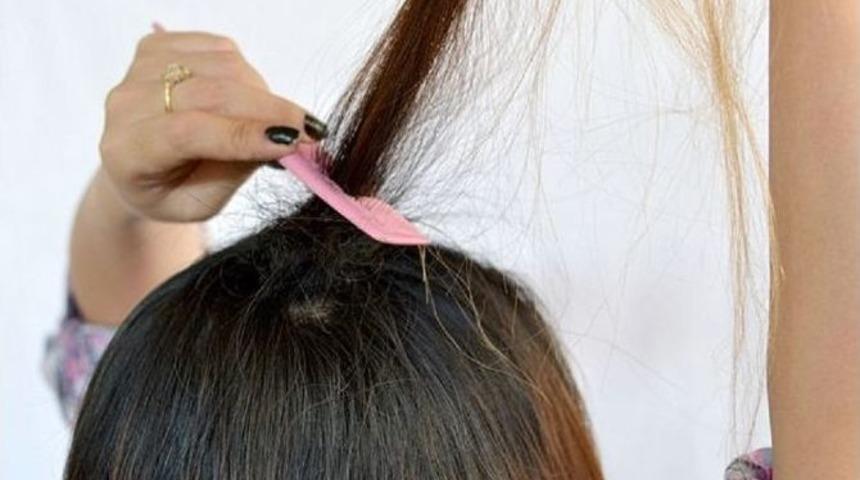 Sa&ccedil; Kaybı, Hem İş Hem Sosyal Hayatı Etkiliyor