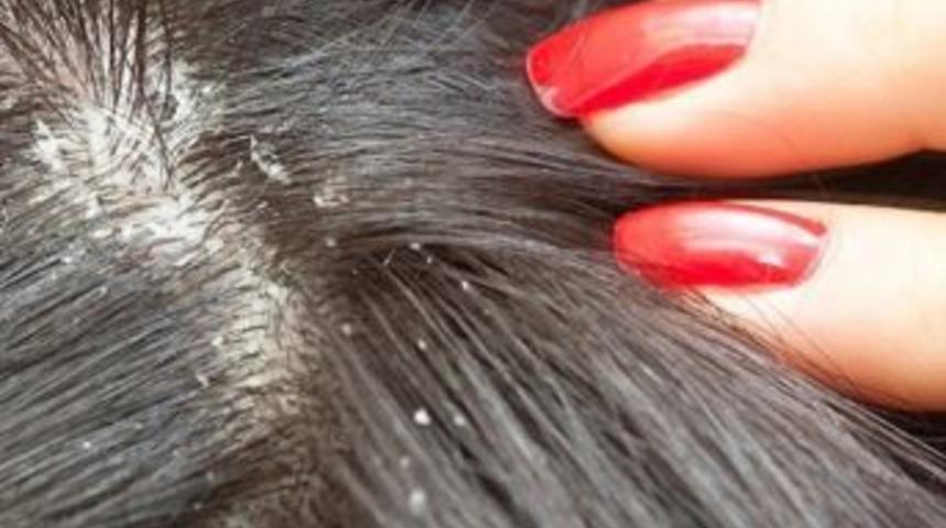 Sa&ccedil;ınızı Sık Sık Şampuanlamayın!