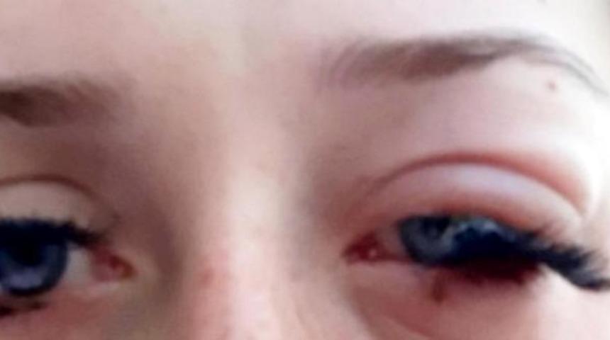  Takma kirpik neredeyse kör edecek, bebeğini göremeyecekti