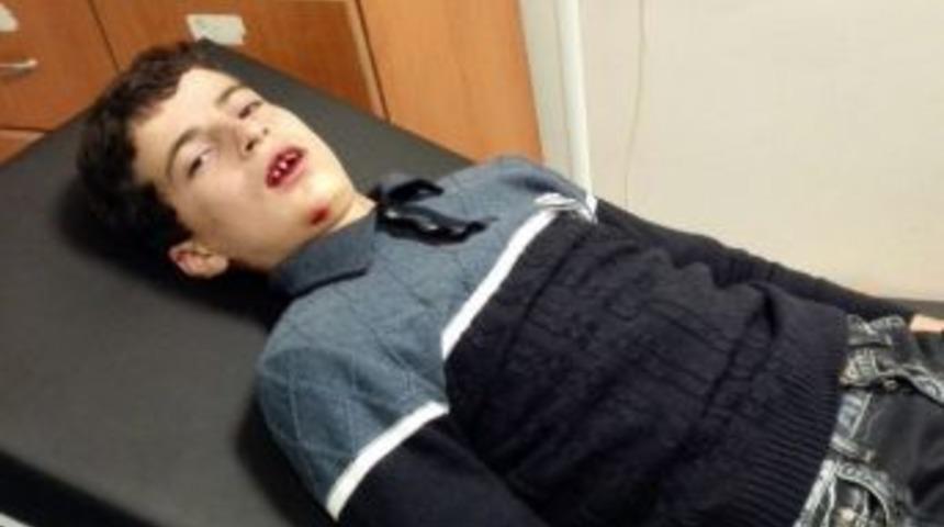 &Ouml;ğretmeni Tarafından Darp Edildiği İleri S&uuml;r&uuml;len &Ouml;ğrenci Hastanelik Oldu