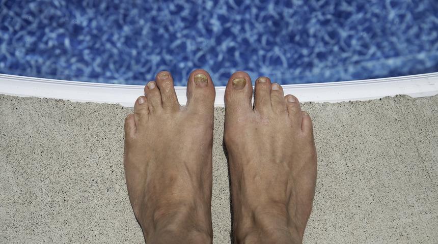 Havuzlardan bulaşabilecek enfeksiyonlara dikkat!