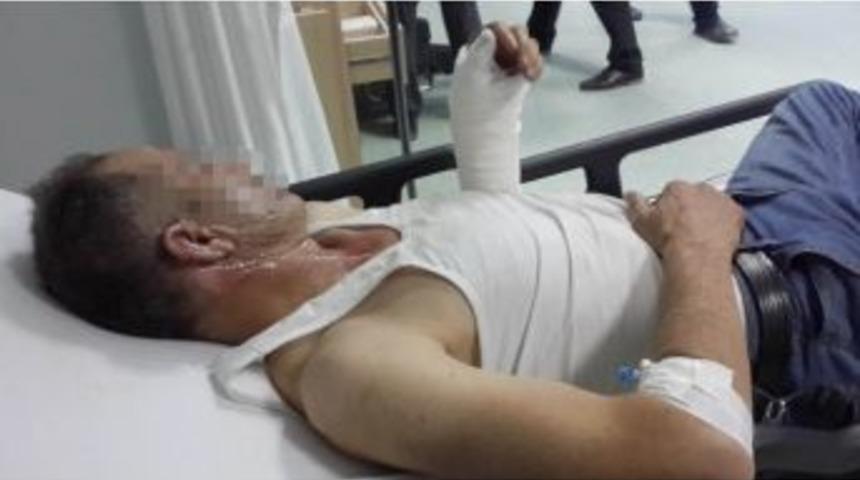 &Ccedil;ay Demlemek İsterken Hastanelik Oldu