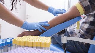 Demir eksikliği belirtileri nelerdir, hangi hastalıklara yol açar? 