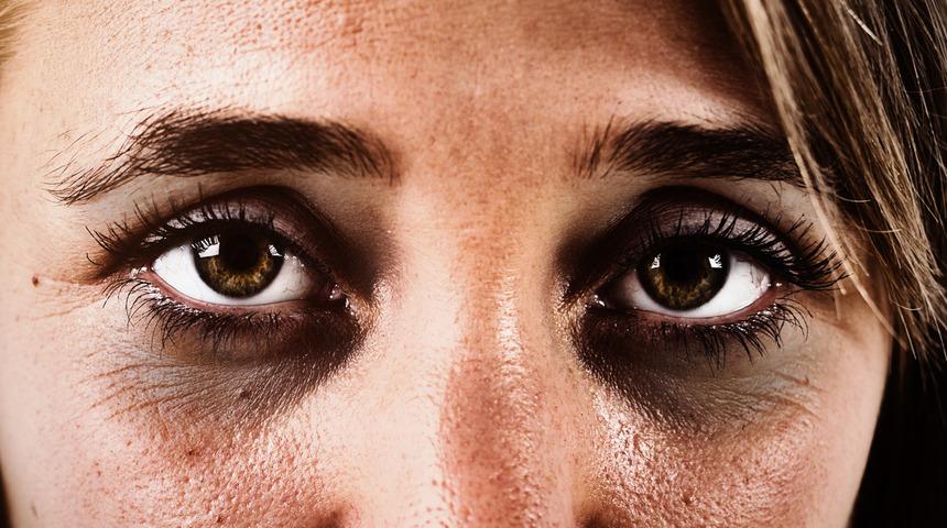 Göz altı morlukları nasıl geçer? İşte en etkili yöntemler