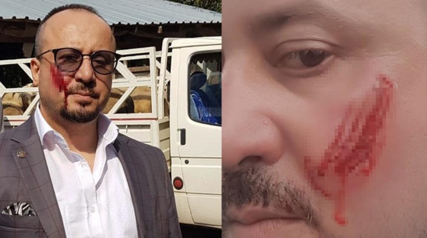 Bursa'da icraya giden avukat dehşeti yaşadı! Yanağını ısırarak kopardı!