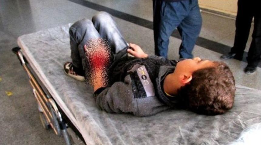 Gaziantep&rsquo;te Otomobilin &Ccedil;arptığı Suriyeli &Ccedil;ocuk Yaralandı