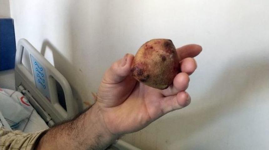 &Ccedil;aycuma Devlet Hastanesi&rsquo;nde Başarılı Ameliyatla Sağlığına Kavuştu