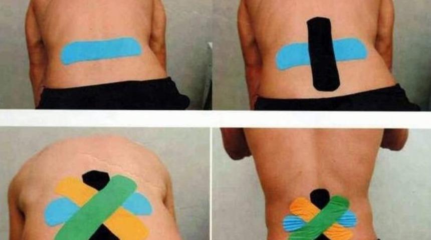 Fizik Tedavide Yeni Trend; Bant Tedavisi