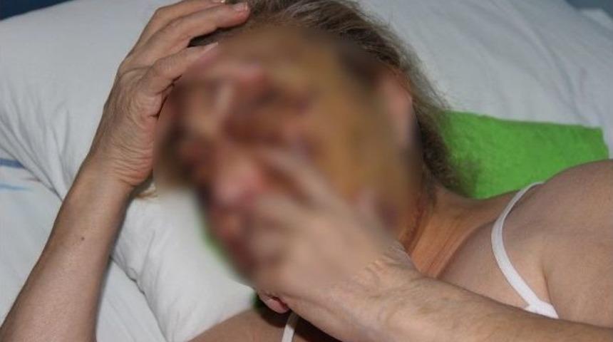 Şiddet G&ouml;ren G&uuml;rc&uuml; Kadına Devlet Sahip &Ccedil;ıktı