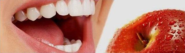 Etkileyici Gülüşün Yeni Formülü 1