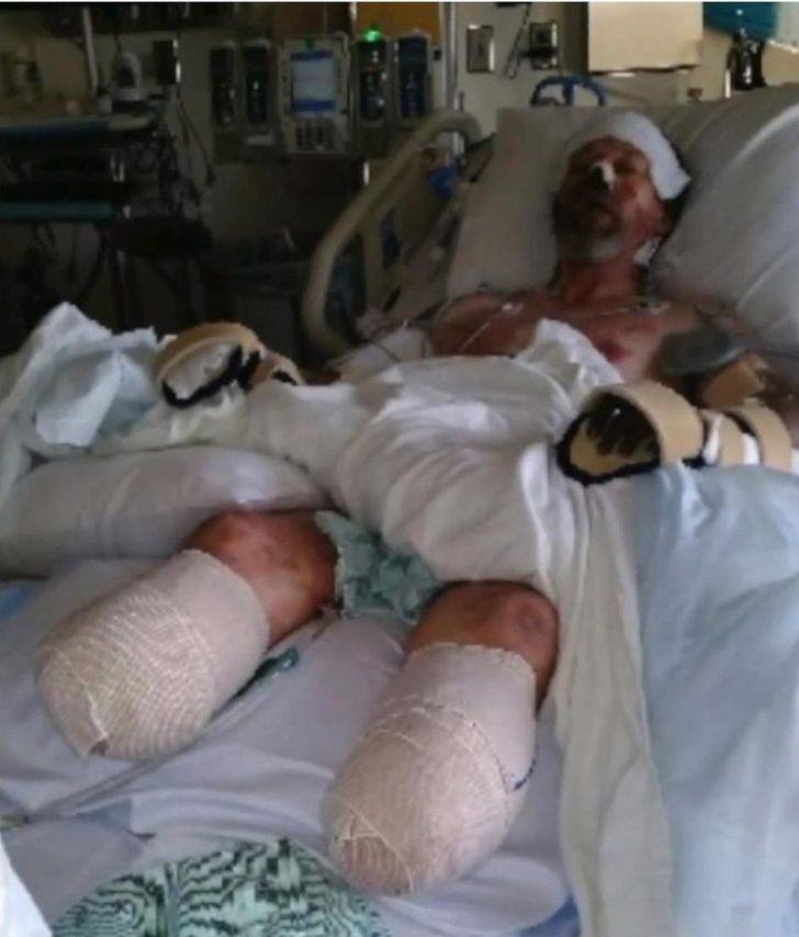 Köpek sevgisi bacaklarından etti! G3