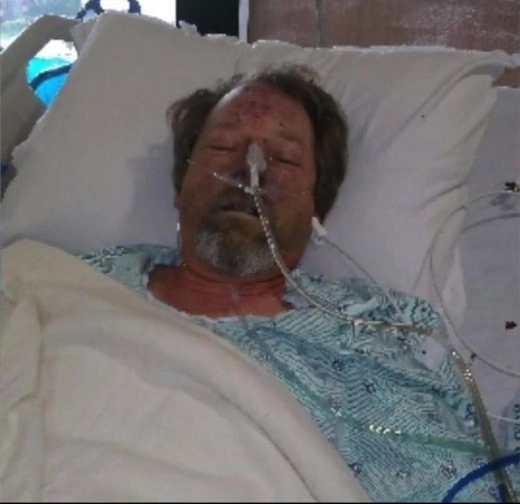 Köpek sevgisi bacaklarından etti! G5