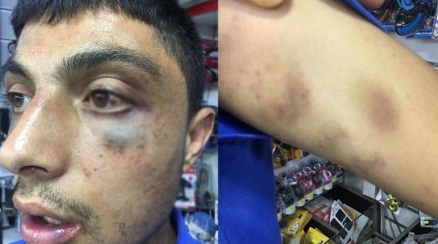 Çorum'da engelli genç darp edilmiş halde bulundu