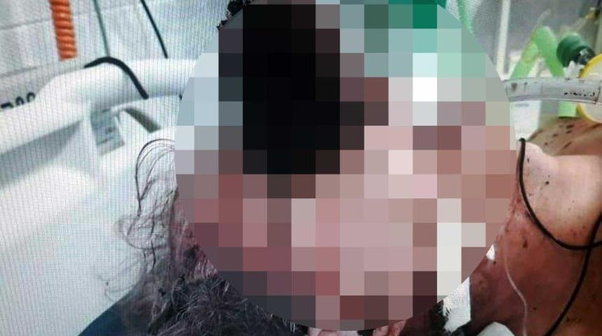 Kan donduran ölüm! Tuvalet fırçası gözüne girdi 