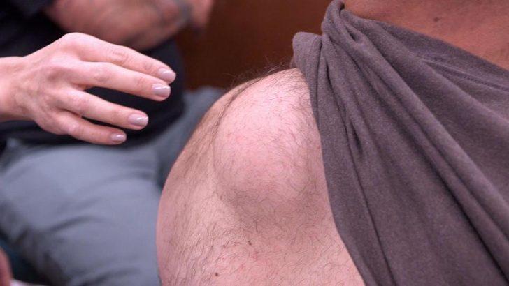 Sırtı bu hale gelince soluğu doktorda aldı G2