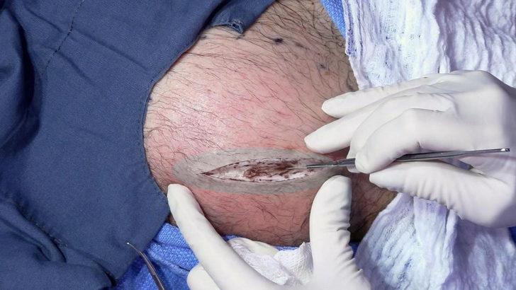 Sırtı bu hale gelince soluğu doktorda aldı G3