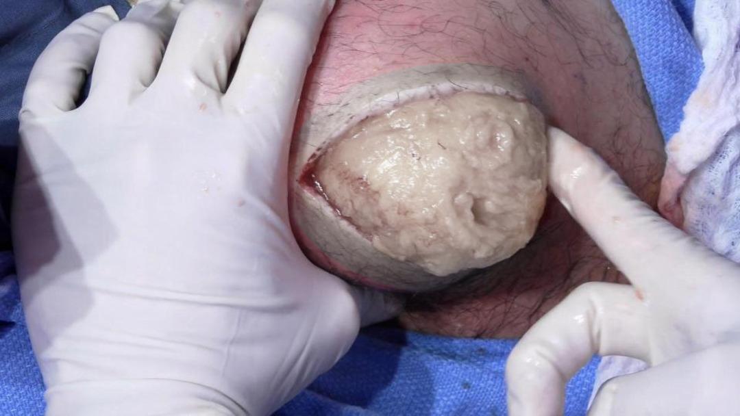 Sırtı bu hale gelince soluğu doktorda aldı