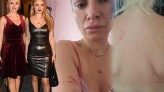 Seçkin Piriler ve Meral Kaplan'ın kavga görüntüleri ortaya çıktı! 