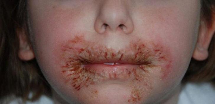 Islak mendille ağzını sildi, bu hale geldi! G1