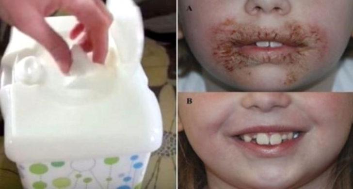 Islak mendille ağzını sildi, bu hale geldi! G4