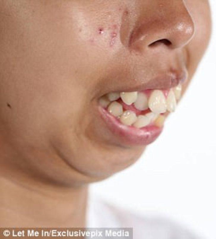 Değişim diye buna denir!  Modellik tekliflerine yetişemiyor G3