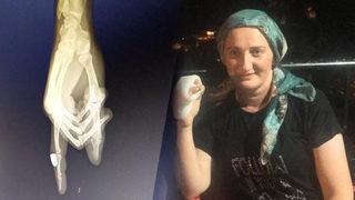 Balkonda otururken parmağına kurşun isabet etti