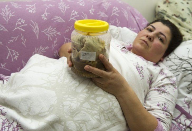 12 yaşındaki kızın midesinden bakın neler çıktı G2