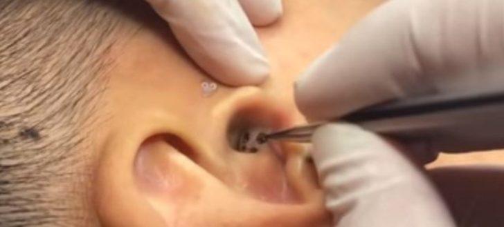 Kulağından çıkanı görenler gözlerine inanamıyor G4