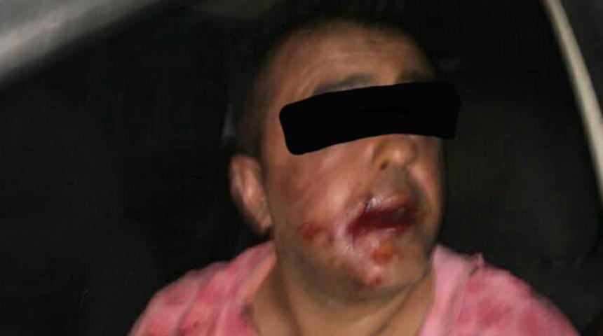 Telefon sapığına meydan dayağı!