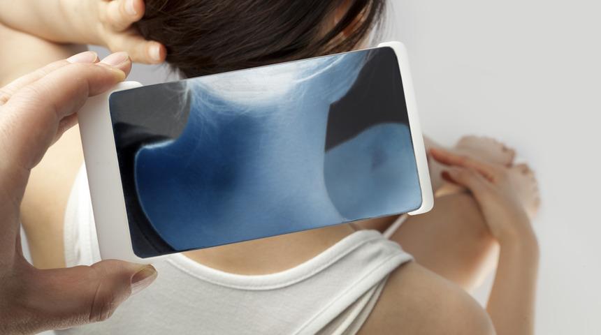 Boyun fıtığı belirtileri nelerdir, tedavisi nasıl yapılır?