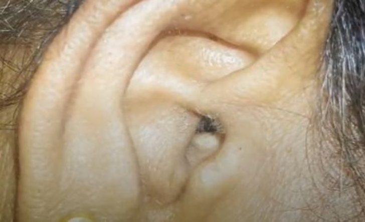 Kulağından çıkanı görenler şaşkına döndü G1