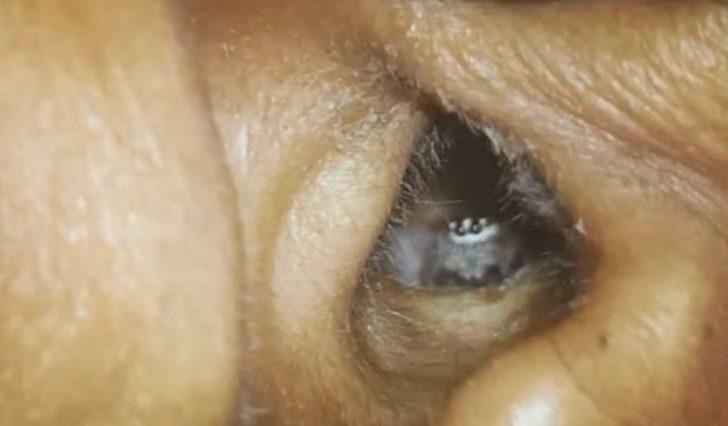 Kulağından çıkanı görenler şaşkına döndü G2