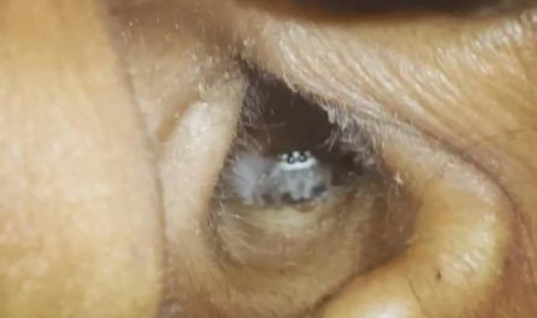 Kulağından &ccedil;ıkanı g&ouml;renler şaşkına d&ouml;nd&uuml;