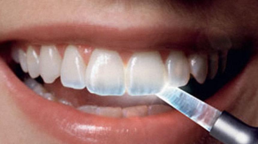 Asit erozyonu nedir? Asit erozyonu sebepleri nelerdir? Asit erozyonu tedavisi nasıl olur?